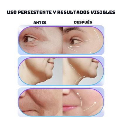 Masajeador facial lifting EMS- Dispositivo Facial de Limpieza con 3 Luces LED